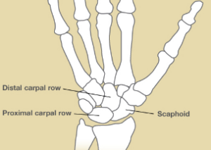 Scaphoid Fracture