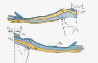 Referred Pain from Cervical Spine Issues