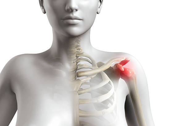 Explore expert advice from Dubai’s trusted shoulder specialist, Dr Marouane, on managing symptoms and treating shoulder impingement.