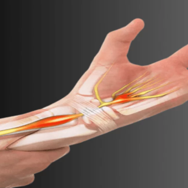 A complete guide to tendinopathy: explore key types, causes, diagnostic techniques, and proven management options for lasting relief.