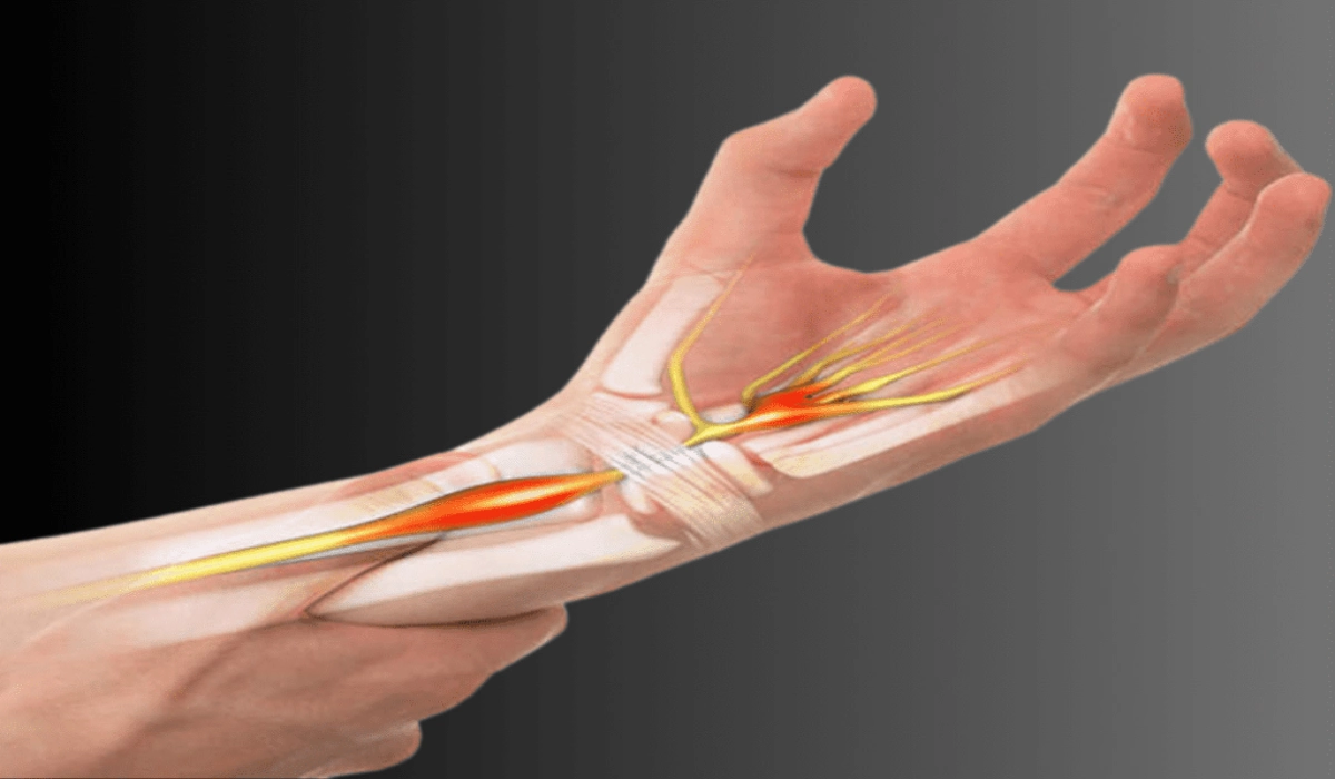 A complete guide to tendinopathy: explore key types, causes, diagnostic techniques, and proven management options for lasting relief.