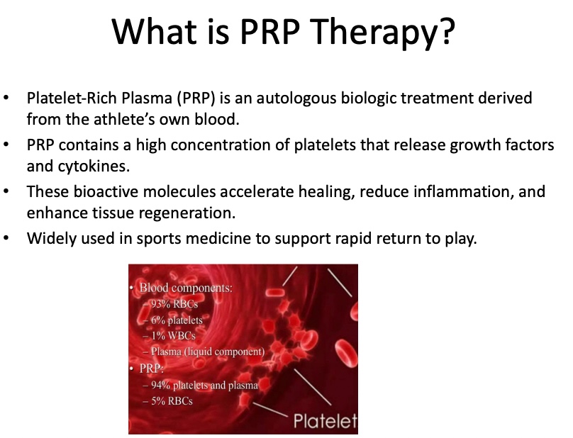 PRP FOR ATHLETE IMPROVEMENT 2 Steps of PRP therapy: blood draw, centrifugation, injection.