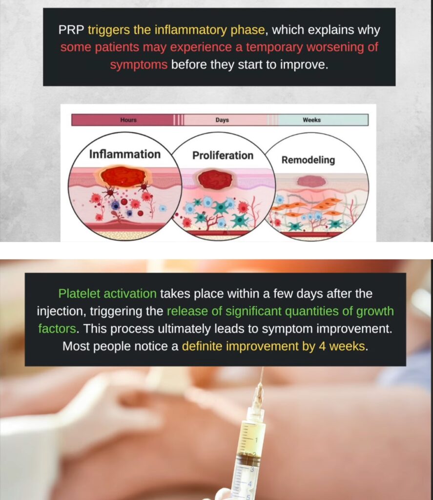 PRP FOR ATHLETE IMPROVEMENT 3 Pain and function improvement over time with PRP therapy.