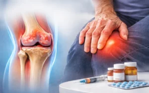 Understand osteoarthritis in joints: discover the types, causes, diagnosis, and advanced treatment options in Dubai to relieve joint pain and restore mobility.