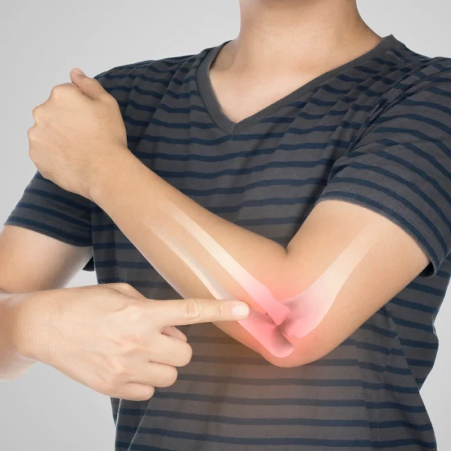 Discover leading regenerative medicine for elbow arthritis in Dubai. Dr. Marouane provides innovative, minimally invasive treatments for lasting joint health.