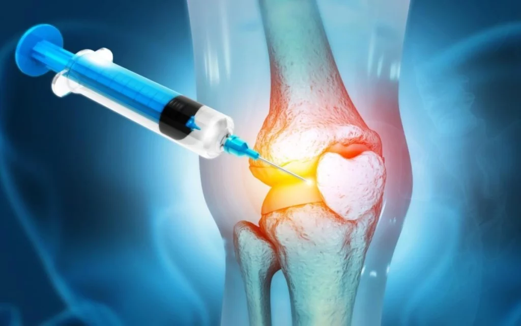 Osteoarthritis in Joints: Types, Causes, Diagnosis & Treatment Options 4 Learn everything about osteoarthritis in joints. We cover types, causes, diagnosis, and the best treatment options in Dubai to help you live pain-free.