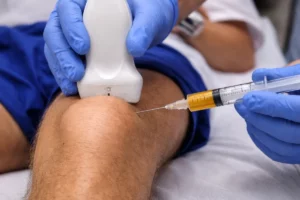 PRP Injections for Knee Osteoarthritis Relief