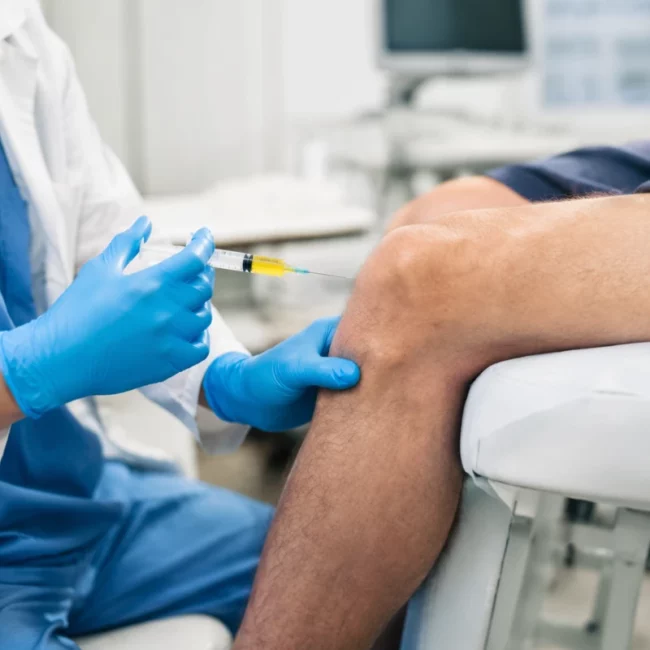Stem Cell Therapy for Knee Arthritis Treatment
