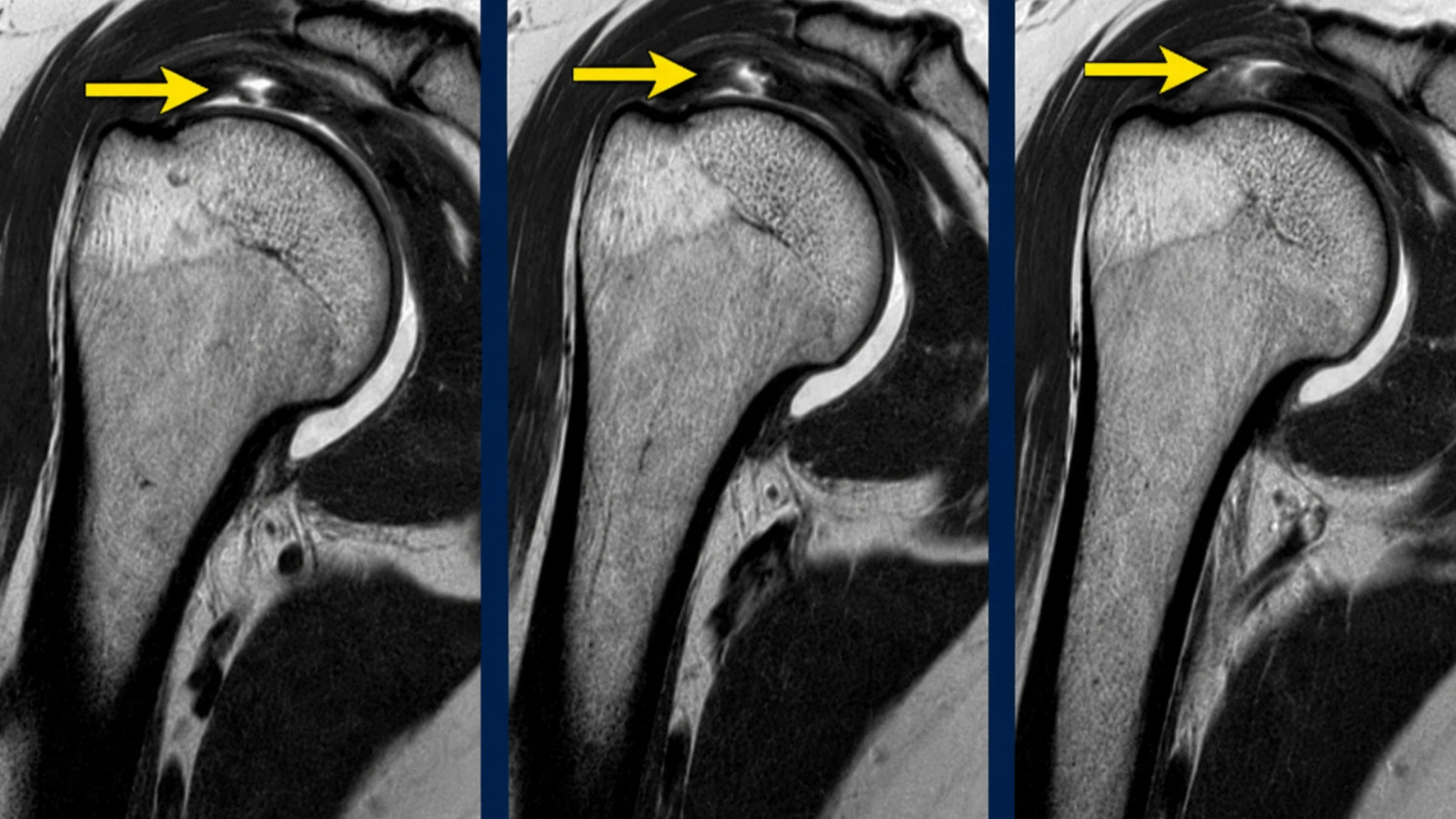 Conditions Where PRP May Be Considered