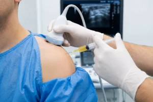 PRP Therapy in Dubai