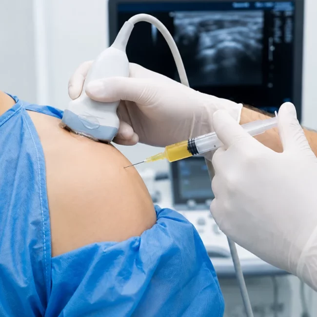 PRP Therapy in Dubai