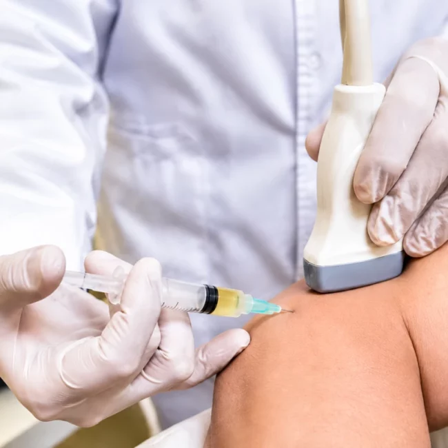 Doctor performing an ultrasound-guided PRP injection for tennis elbow to promote tendon healing and pain relief.