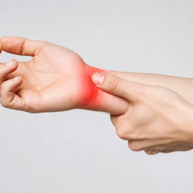 Person experiencing wrist pain and numbness associated with carpal tunnel syndrome and median nerve compression.