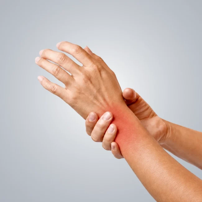 Person holding a painful wrist with visible inflammation and discomfort
