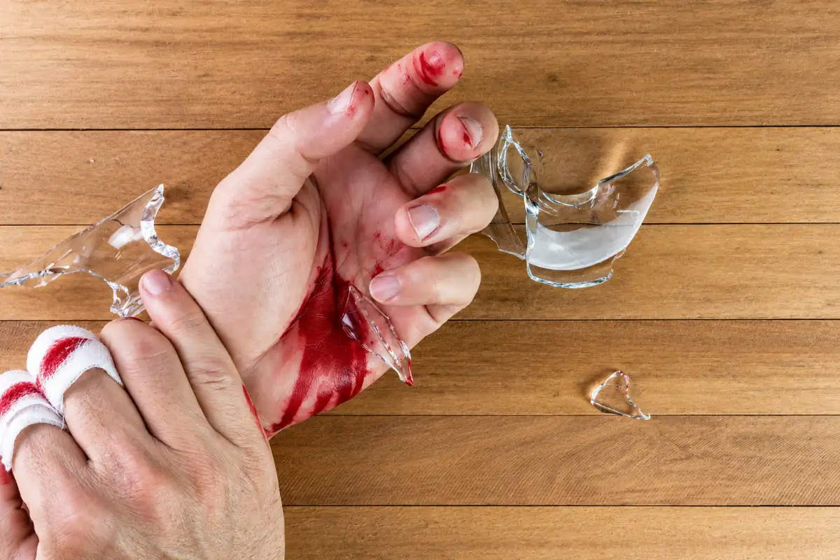 Deep cut to the hand caused by broken glass, with bleeding fingers and palm that may require urgent medical assessment.
