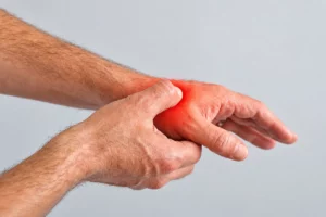 Thumb base arthritis: Person holding the base of the thumb to indicate pain associated with thumb CMC osteoarthritis.